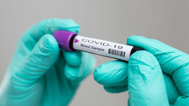 UP-NIH Targets 16K COVID-19 Tests Per Day By May 1